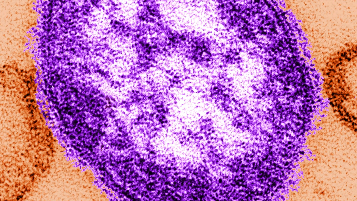 Oregon health officials confirm first measles cases of 2026