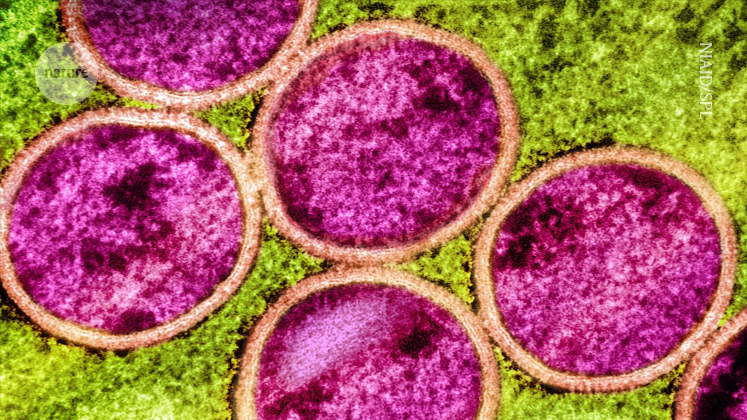 Will mpox go global again? Research shows it’s evolving in curious ways