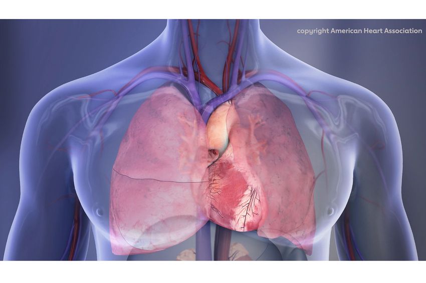 First AHA/ACC acute pulmonary embolism guideline: prompt diagnosis and treatment are key