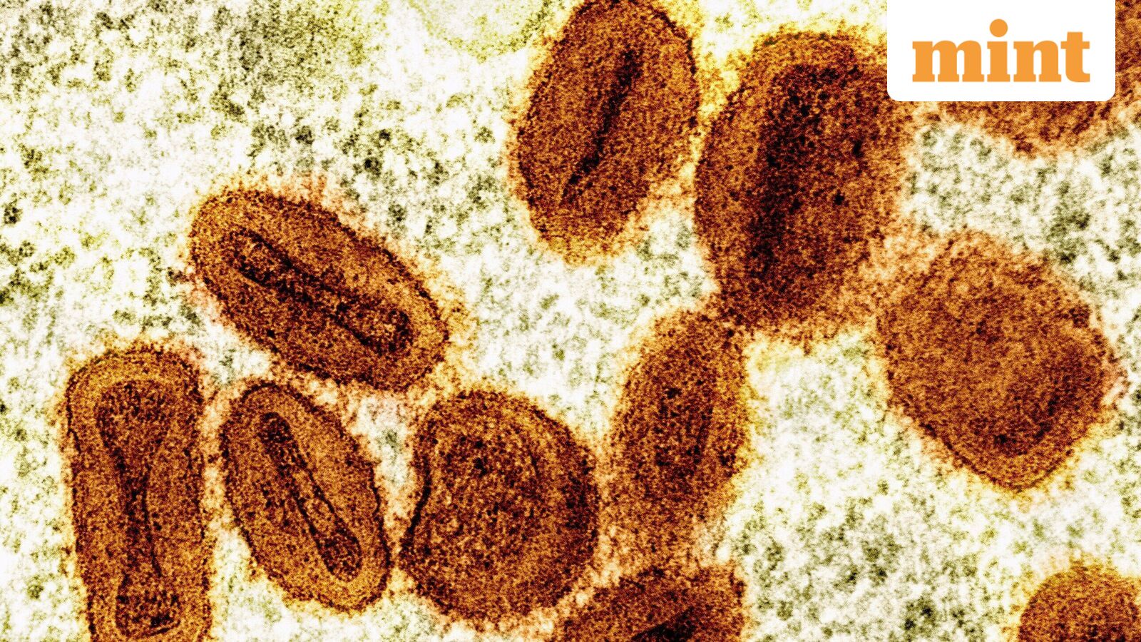 New York City detects first known case of severe Mpox strain, health department issues advisory – all you need to know